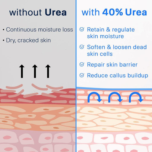 Urea vs Hyaluronic Acid: Which One Is Better for Dry Skin?